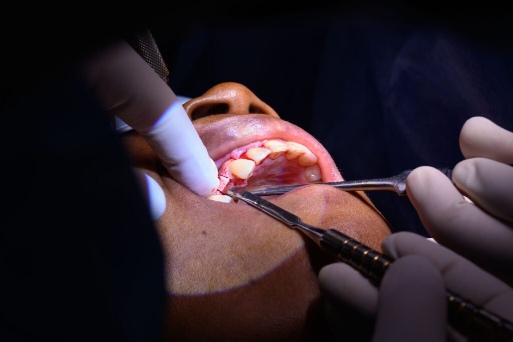 Chirurgie orthodontique